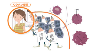 子宮頸がんワクチン
